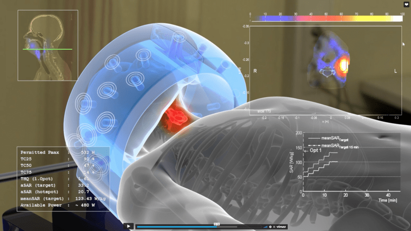 Sensius secures €15 million to advance breakthrough cancer thermotherapy